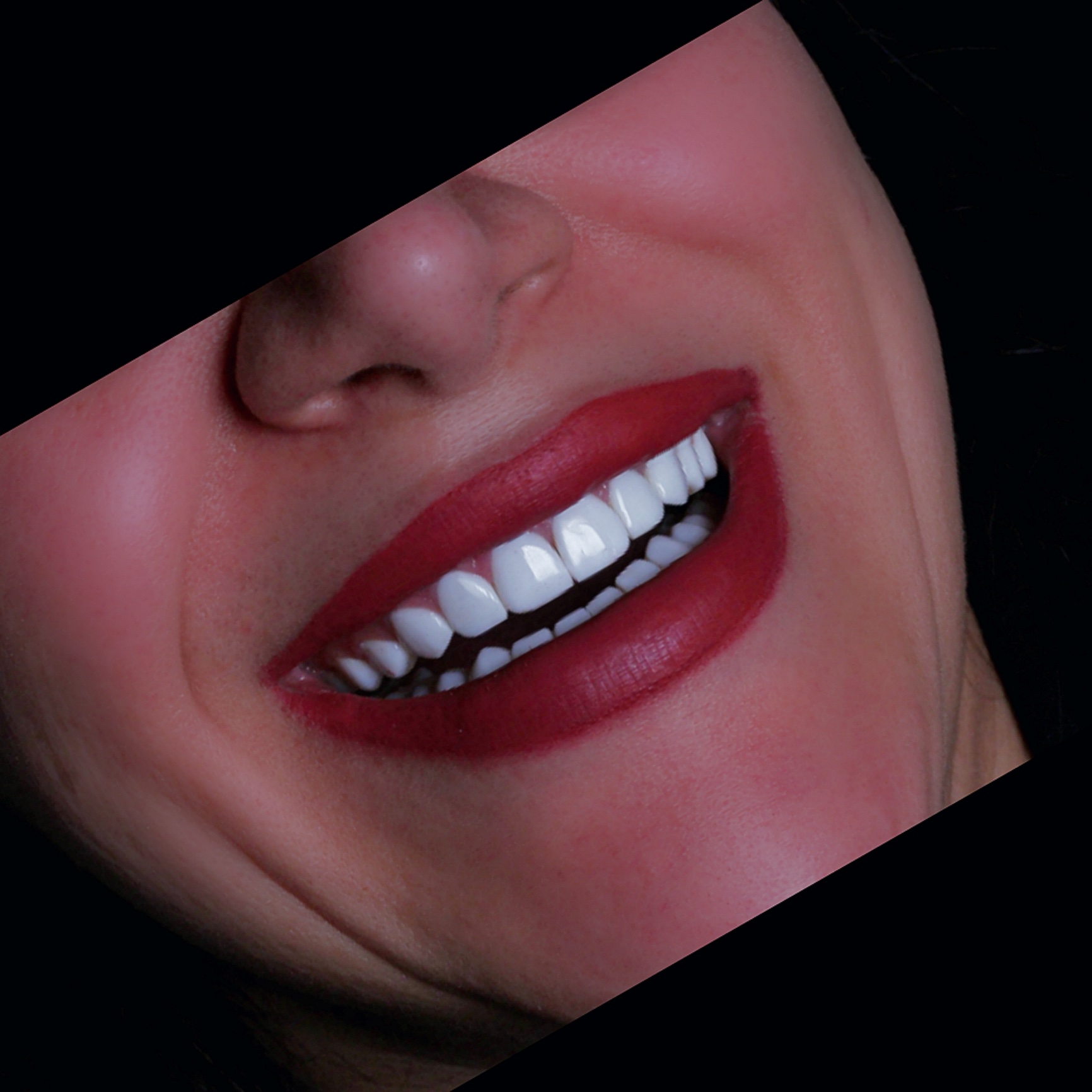 ونیر کامپوزیت