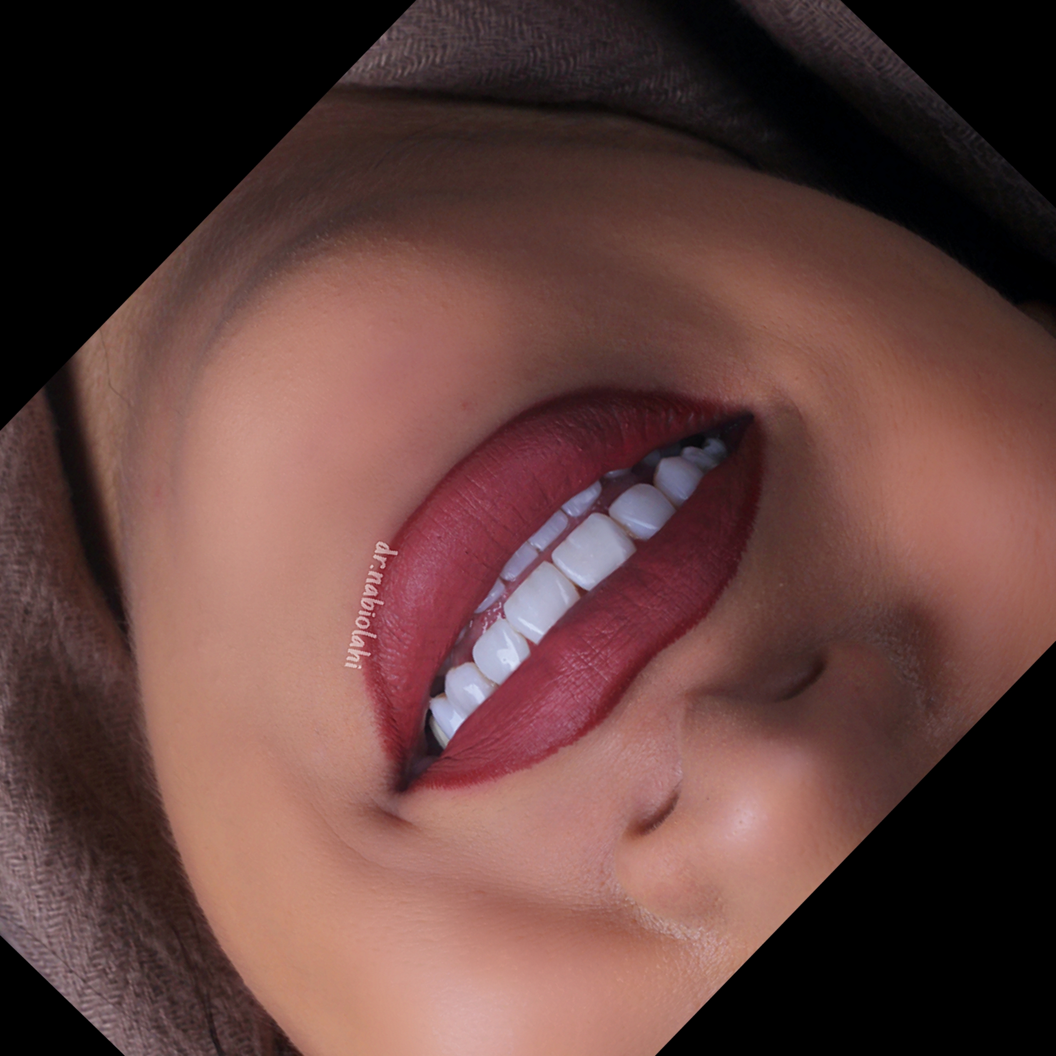 ونیر کامپوزیت